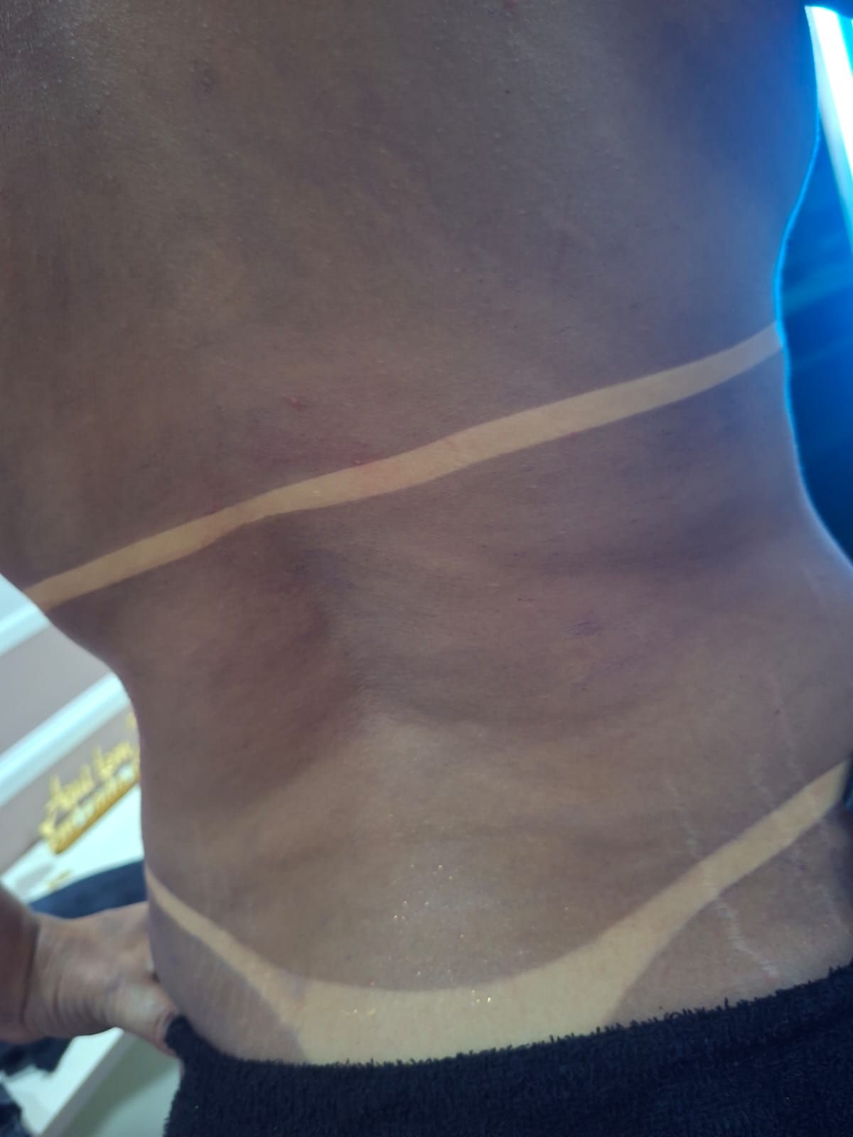 Resultado Bronzeamento